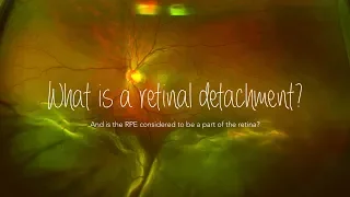 Retinal Detachment