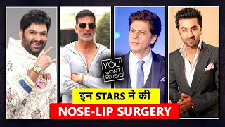 😱 Bollywood Stars Who Had Plastic Surgery 😱 | Shahid, Aamir, Shahrukh, Akshay