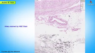 Histology of Artery and vein - Shotgun Histology