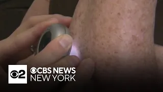 Not enough people taking right precautions against skin cancer, dermatologists say