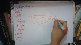 ASTIGMATISM complete concept with diagrams    made easy  part 2