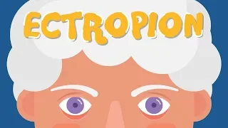 What is Ectropion?