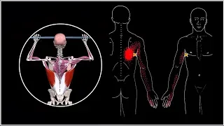 Severe pain in the scapula. The broadest muscle of the back. Anatomy, Functions, Trigger Points