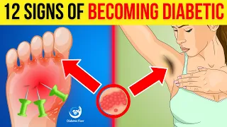 12 Early SYMPTOMS of DIABETES