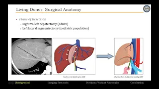 48. Imaging Evaluation of Liver Transplantation Part 1. By Prof. Dr. Amir Borhani