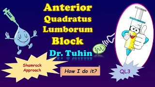 Quadratus Lumborum (QL) Block : Anterior approach | Transmuscular QLB | Type 3 QL Block| Ultrasound