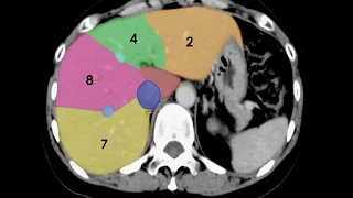 8 Hepatic Imaging (part1) -  Prof.Mamdouh mahfouz (2019 edition)