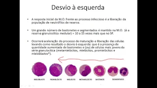 Aula Interpretação do Leucograma