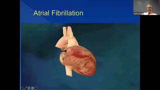 AFib Ablations, Dr. Alsheikh, Community AFib Webinar