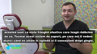 Esti fumator si ai nevoie de implant dentar?