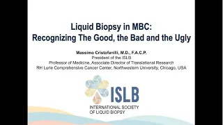 Liquid Biopsy in MBC:  Recognizing The Bad, The Good, and The Ugly