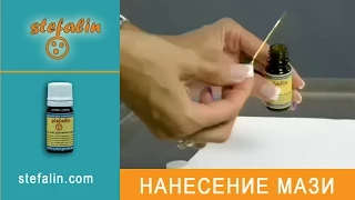 Нанесение на родинку мази Стефалин. Удаление родинки.