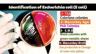 Escherichia coli (E coli) Identification on (EMB, TSA, Macconkey broth & MacConkey Agar)