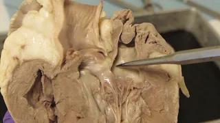 Heart Dissection Internal Anatomy