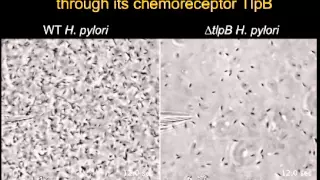 Helicobacter pylori Senses Urea as an Attractant through Its Chemoreceptor TlpB