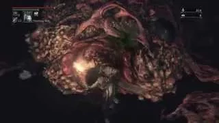 How to easily kill Mother Brain Bloodborne