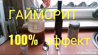 ЛЕЧЕНИЕ ГАЙМОРИТА♡ЭФФЕКТ ПОСЛЕ ПЕРВОГО РАЗА♡