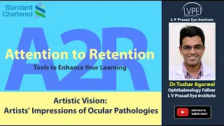 Attention to Retention!: Eye Cast #003