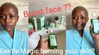 #skincare #morningroutine This might be why the gentle magic skincare lotion is burning your skin