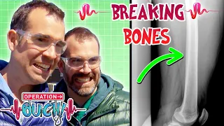 Why Do Bones Break?! 🦴 | Full Episode | Science for Kids | @OperationOuch