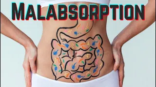 Malabsorption - CRASH! Medical Review Series