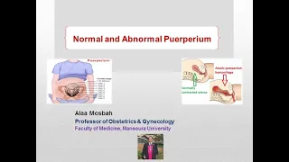 Normal and Abnormal Puerperium