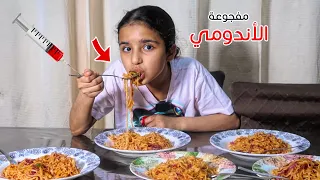 لما مفجوعة الاندومي تجرب  ترند الأندومي الحار 😭  والدكتور يعطيها 💉شوفو شو صار !😂 - سوالف بناتي