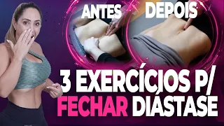 3 Exercícios OBRIGATÓRIOS para FECHAR qualquer DIÁSTASE (SEM CIRURGIA)