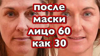 Всего 1 Раз в неделю и Лицо Моложе на 10 Лет ! Маска для лица от Морщин/Рецепт