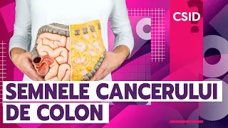 Cancerul de colon: 10 semne care să te îngrijoreze