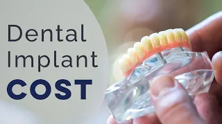 Cost of Dental Implants | Columbus Ohio | Runion Dental Group