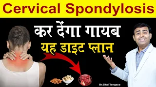 सर्वाइकल स्पांडिलाइसिस को कर देंगा गायब यह डाइट प्लान II Cervical Spondylosis Diet plan