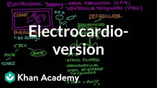 Electrocardioversion | Circulatory System and Disease | NCLEX-RN | Khan Academy