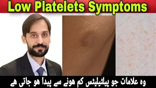 Symptoms of Low Platelet Count