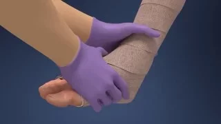 Coban 2 Fragile Leg Application Animated