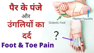 पैर के पंजे और पैर की उंगलियों का दर्द | Foot and toe pain |Dr. vivek Gaur Physiotherapist