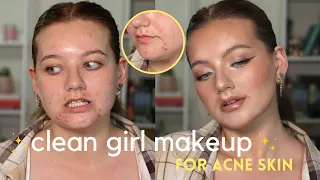 *in depth* CLEAN GIRL makeup tutorial for acne/textured/scarred skin