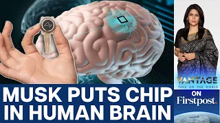 Elon Musk's Neuralink puts First Brain Chip in a Human | Vantage with Palki Sharma