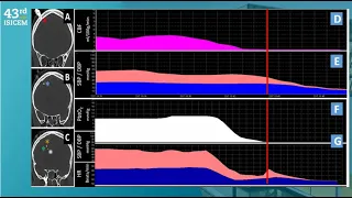 SHOCK THE BASICS   ISICEM 2024