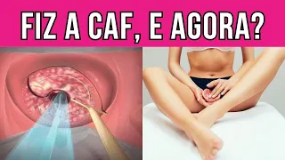 O que acontece após a CAF? #cirurgiadealtafrequência