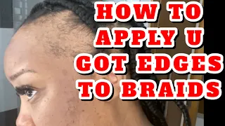 HOW TO COVER BALD SPOTS or NO EDGES • U GOT EDGES x BRAIDS | Severe Alopecia | Instant Edges