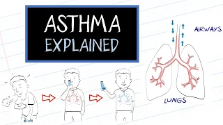 What is Asthma? (HealthSketch)