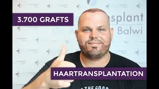 Haar und Barthaartransplantation Türkei -  Erfahrung Istanbul