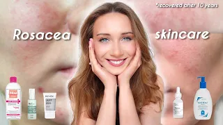 ROSACEA SKINCARE *From Someone Who Recovered After 10 Years*