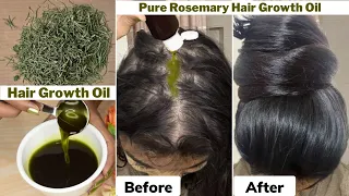 I used👆🏼this Rosemary Hair Growth Oil on Thinning Hair & Bald Scalp-Got 10 times Thick Hair Growth
