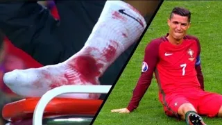18 terribles blessures du football