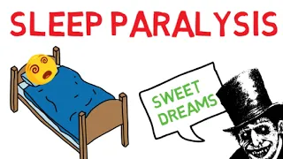 Sleep Paralysis Explained | Symptoms, Causes, and Treatments