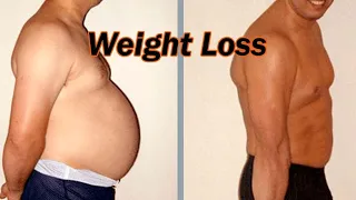 Weight Loss Surgery | मोटापा घटाएं  | Weight Loss Treatment In Ludhiana, Punjab India