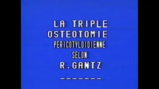 La Triple Osteotomie Pericotyloidienne