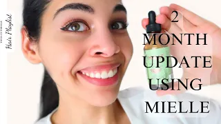 Rapid Hair Growth *RESULTS* Using Mielle Rosemary Mint Oil